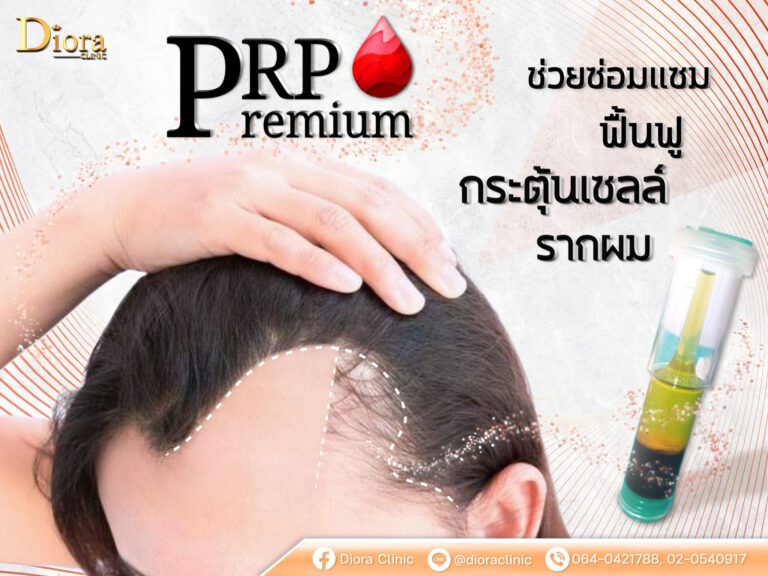 PRP hair