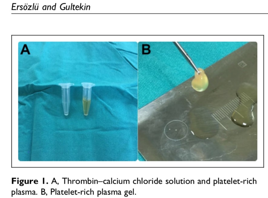 plasma gel