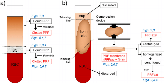 plasma gel