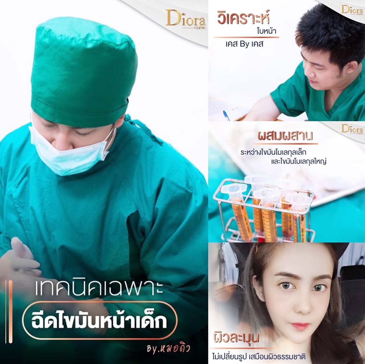 ฉีดไขมันที่ diora clinic ดีอย่างไร