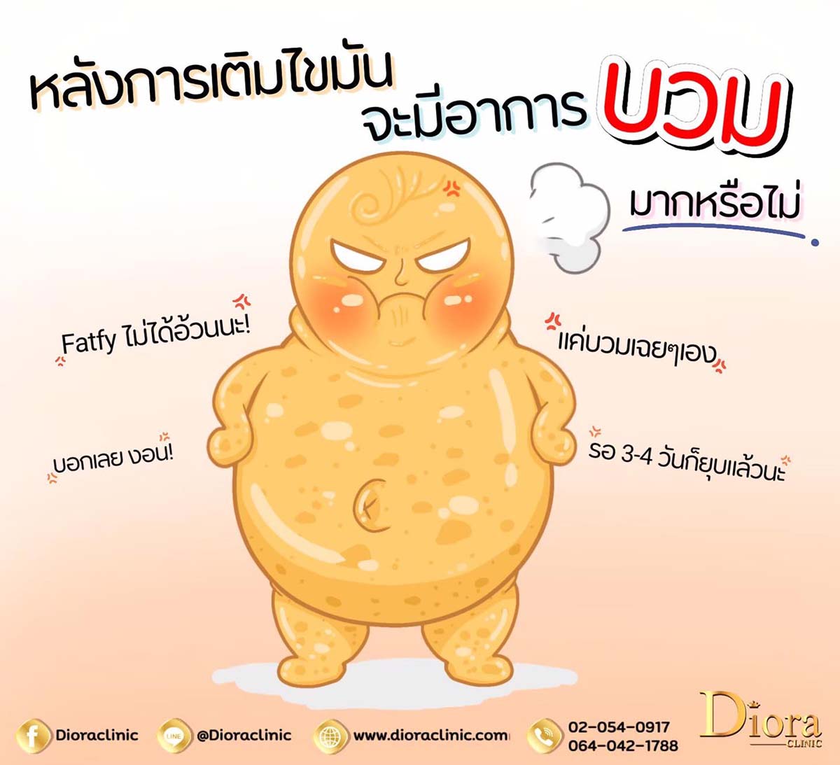 หลังฉีดไขมันหน้าบวมกี่วัน