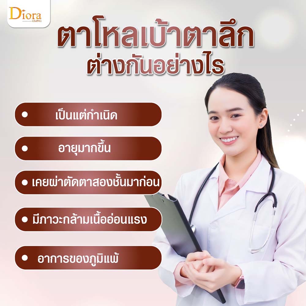 ตาโหล เบ้าตาลึก ต่างกันอย่างไร