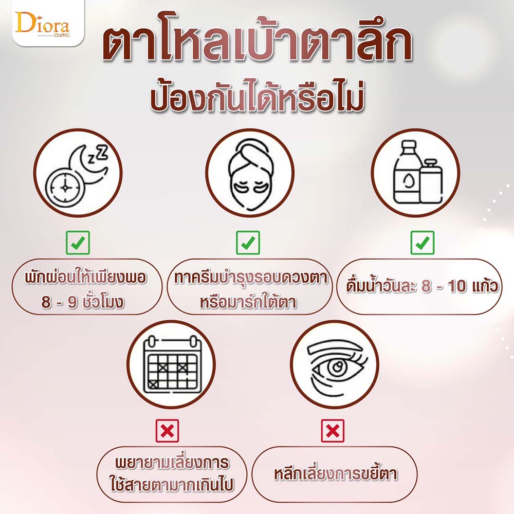 ตาโหลเบ้าตาลึก ป้องกันอย่างไร